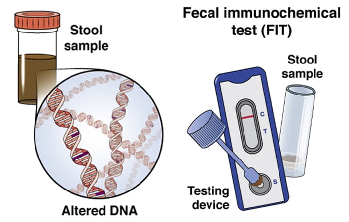 Cologuard test (FIT+DNA)