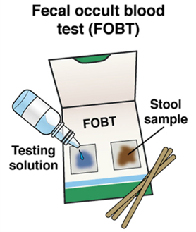 Fecal occult blood test (FOBT)