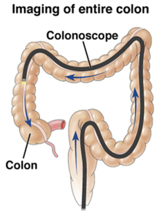 Imaging of entire colon