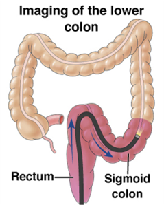 Imaging of the lower colon